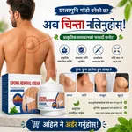 Lipoma Remover Cream - Targeted Skin Care Cream for Lipoma-Prone Areas - Available at AfnoBazar Nepal