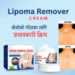 Lipoma Remover Cream - Targeted Skin Care Cream for Lipoma-Prone Areas - Available at AfnoBazar Nepal