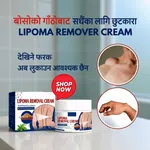 Lipoma Remover Cream - Targeted Skin Care Cream for Lipoma-Prone Areas - Available at AfnoBazar Nepal