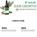Hair Growth & Hair Fall Control Serum 30ml - Serum Concentrate - Available at AfnoBazar Nepal