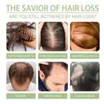 Natural Herbal Hair Oil 250ml - Adivasi Formula for Stronger Looking Hair image 3