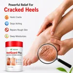 Vakari Heel Guard Plus 100g - Cracked Heel Repair Cream for Dry and Rough Feet image 2