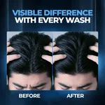 Beardo Dandruff Control Sulphate Free Shampoo 200ml image 4