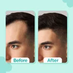 The Derma Co 20% Actives Peptide-Stem Cell Hair Growth Serum with Foligen Analupe & Anagain - 30ml - Available at AfnoBazar Nepal