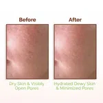 Mamaearth Rice Water Dewy Face Toner with 96% Rice Water & 4% Niacinamide for Glass Skin - 150ml - Available at AfnoBazar Nepal