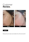 Minimalist Niacinamide 5% Face Serum with Hyaluronic Acid - 30 ml - Available at AfnoBazar Nepal