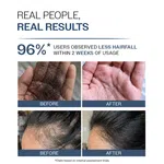 Bare Anatomy Expert Anti-Hair Fall Shampoo with Adenosine & Peptides - 250 ml - Available at AfnoBazar Nepal