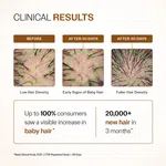 Bare Anatomy Expert Advanced Hair Growth Serum with 3% Redensyl & 4% Anagain - 30 ml - Available at AfnoBazar Nepal