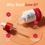 Chemist at Play Acne Control Face Serum with 2% Salicylic Acid & Lactic Acid - 30 ml - Available at AfnoBazar Nepal