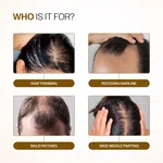 Bare Anatomy Advanced Hair Growth Serum Roll-On with 5% Rosemary & 3% Redensyl - 25 ml - Available at AfnoBazar Nepal