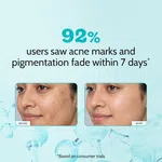 Chemist at Play 10% Niacinamide Clarifying Face Serum for Dark Spots - 10 ml - Available at AfnoBazar Nepal