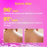 Chemist at Play 1% Salicylic Acid Body Wash for Body Acne - 236 ml - Available at AfnoBazar Nepal