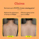 Chemist At Play 1% Salicylic Acid Acne Control Body Wash 236ml - Available at AfnoBazar Nepal