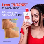 Chemist At Play 1% Salicylic Acid Acne Control Body Wash 236ml - Available at AfnoBazar Nepal
