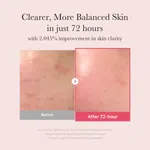 Medicube TXA Niacinamide Serum 30ml - Available at AfnoBazar Nepal