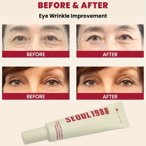KSECRET SEOUL 1988 Eye Cream – Retinol Eye Care for Wrinkles, Anti-Aging, Skin Elasticity, Pigmentation & Brightening (30ml / 1.01 fl.oz.)