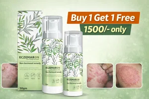 Eczemaron Anti-Fungal Cream 50gm (Buy 1 Get 1 Free) | Eczema, Ringworm & Itching Relief | Non-Hormonal Skin Repair Formula