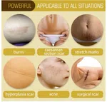 Pei Mei Collagen Scar and Acne Mark Removal Repair Essence