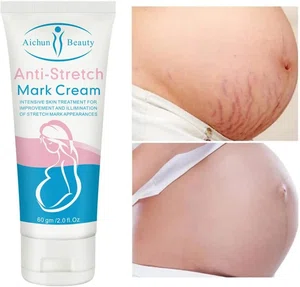 Aichun Beauty Whitening Stretch Marks Repair Cream Scar Repair Maternity Repair To Nourishing Cream Moisturizer Growth Lines Massage Skin Body-60g