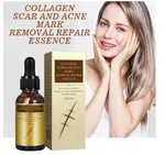 Pei Mei Collagen Scar and Acne Mark Removal Repair Essence