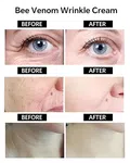 Premium Bee Venom Anti-Wrinkle & Firming Cream – Advanced Anti-Aging Therapy