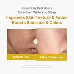 ​Medicube Kojic Acid Turmeric Night Wrapping Mask (75ml) – Brightening Overnight Face Mask for Dullness, Dark Spots & Glowing Skin