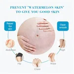 Aichun Beauty Whitening Stretch Marks Repair Cream Scar Repair Maternity Repair To Nourishing Cream Moisturizer Growth Lines Massage Skin Body-60g