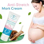 Aichun Beauty Whitening Stretch Marks Repair Cream Scar Repair Maternity Repair To Nourishing Cream Moisturizer Growth Lines Massage Skin Body-60g
