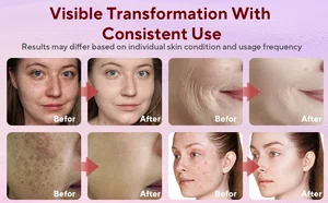 Viral Biodance Collagen Mask - Bio-Collagen Real Deep Mask 34g - Deep Hydration & Glass Skin Pore Minimizing Mask