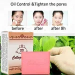 Collagen Acne Soap 701 | Pimple Removal & Oil Control | Skin Whitening & Acne Scar Treatment Face Soap