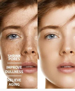 Nicotinamide Whitening Serum (30ml) - Dark Spot & Freckle Remover Face Essence for Brightening & Anti-Aging