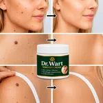 Wart Remover Cream image 1