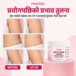 Health & Beauty Skin Care Body Care Stretch Mark Care image 2