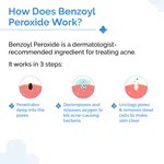 The Derma Co 2.5% Benzoyl Peroxide Gel Face Wash with Glycerin & Allantoin for Active Acne - 100ml image 3
