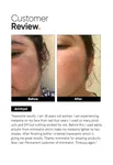 Minimalist Tranexamic 3% Face Serum - 30 ml image 5